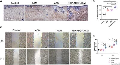 Delivery of adipose-derived growth factors from heparinized adipose acellular matrix accelerates wound healing